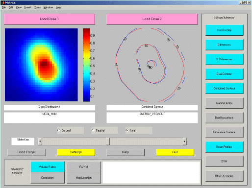 The MetriX interface
